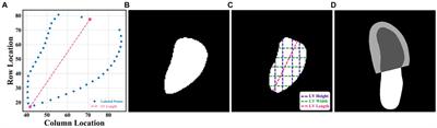 Development of automated neural network prediction for echocardiographic left ventricular ejection fraction